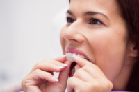 Understanding Aligner Remover Tools and Their Role in Oral Health